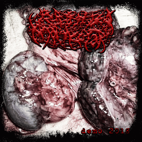 Fermented Anal Nectar : Demo